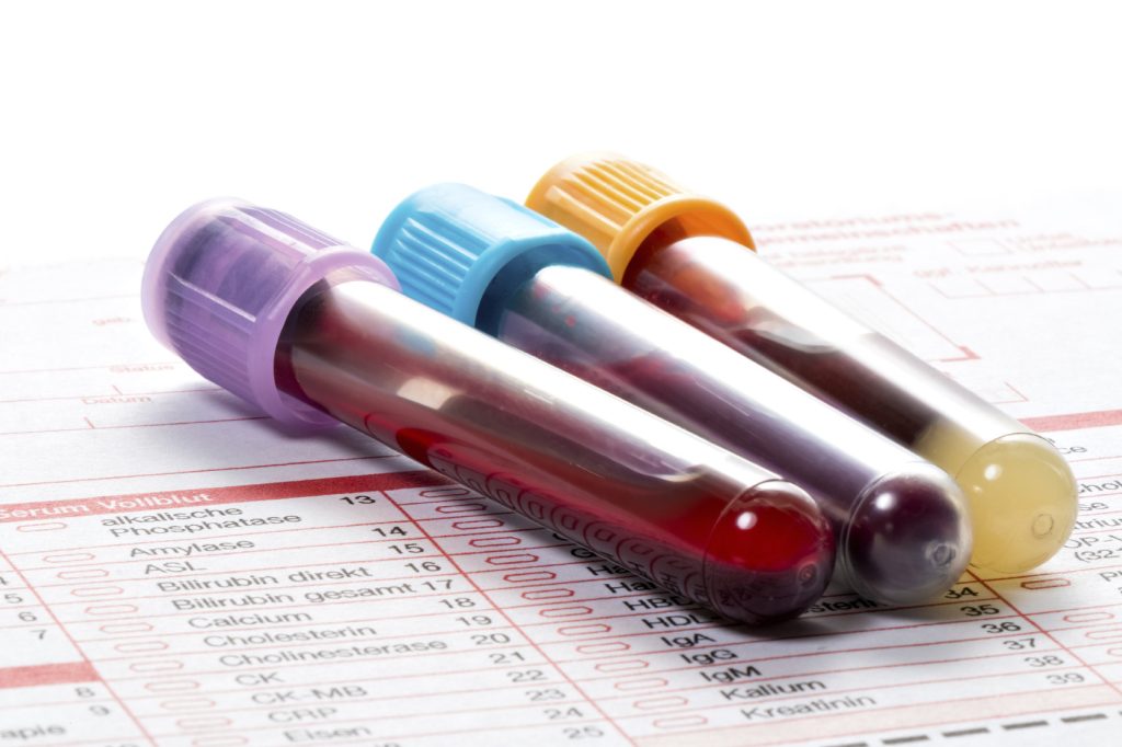 Blood Work Med Spa Washington DC