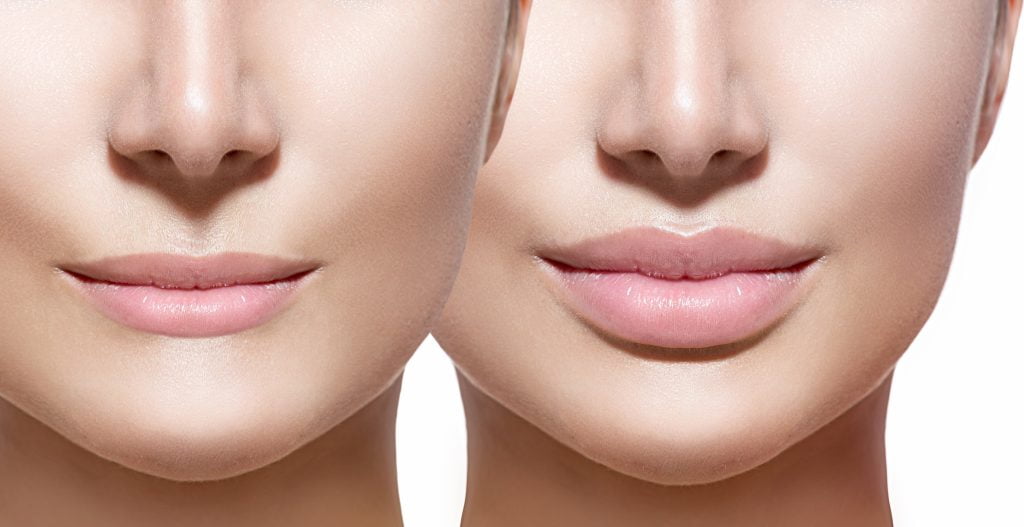 lip filler washington d.c. Archives - The District Injector Men's Clinic Format:Lyophilized Powder lose weight Lo último para cambiar
