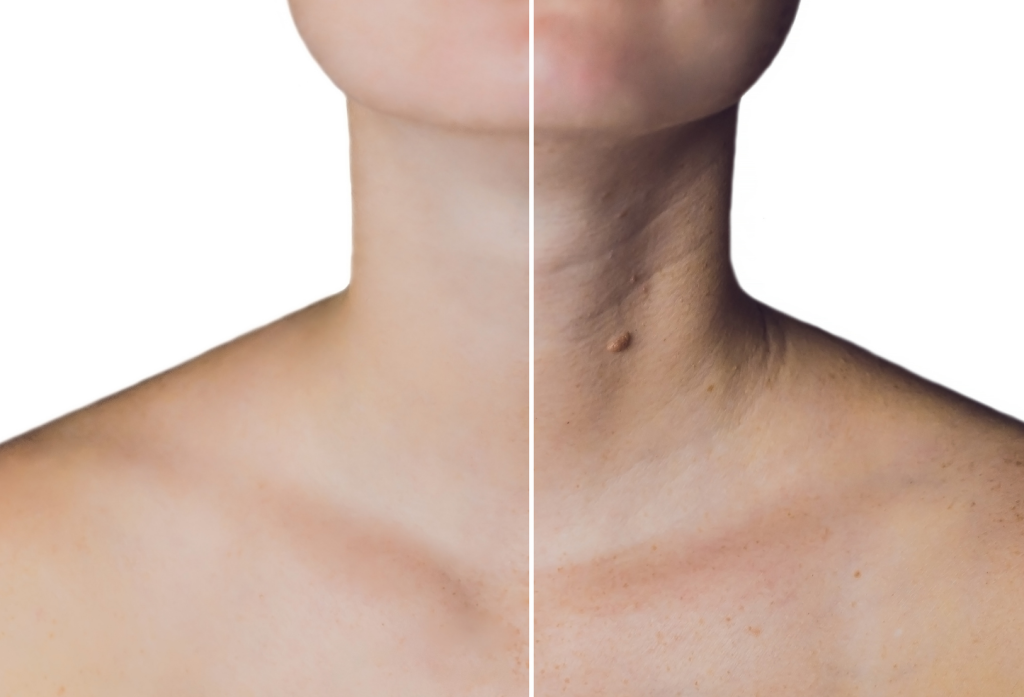 Tech Neck