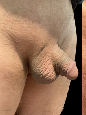 Before & After 29 before