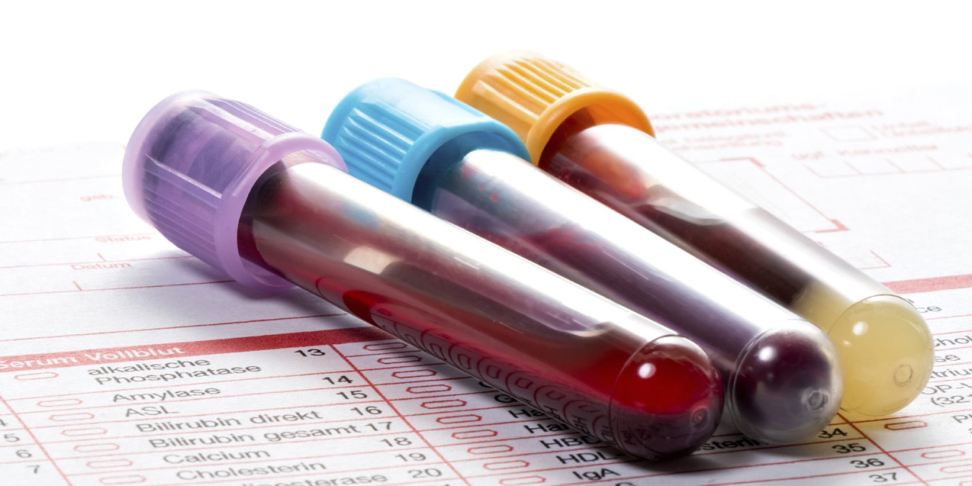 Blood Work Med Spa Washington DC