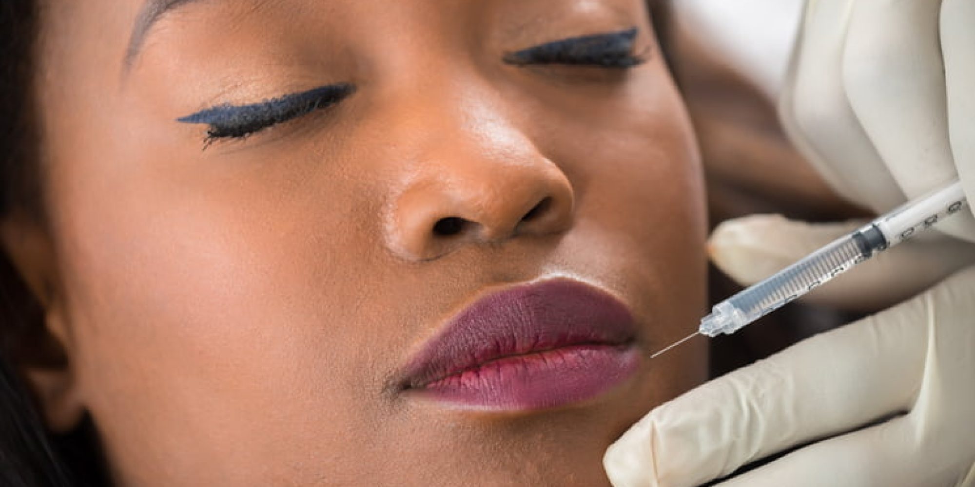 Dissolve Filler Treatment Med Spa Washington DC