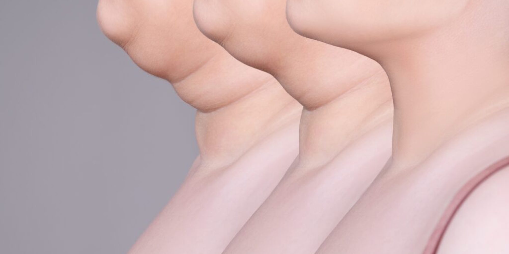 Double Chin Treatment Med Spa Washington DC