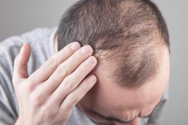 Hair Restoration Med Spa Washington DC