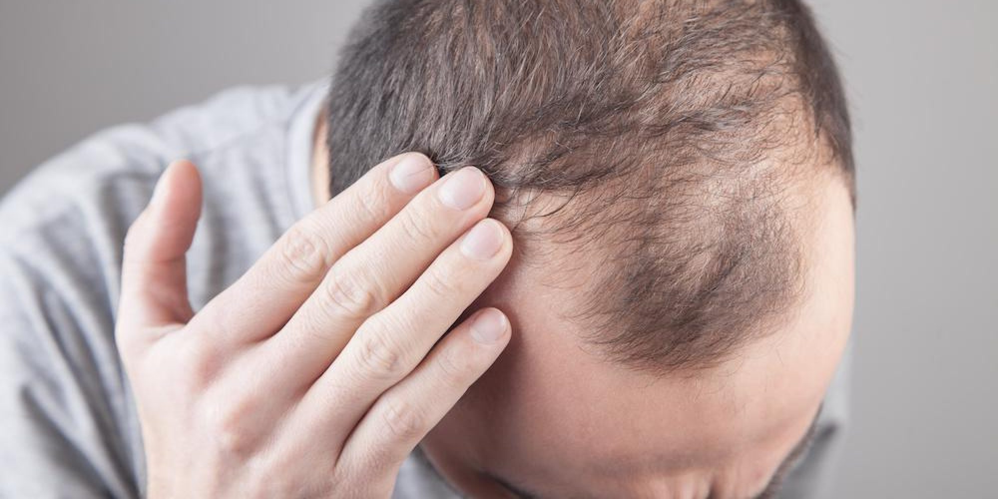 Hair Restoration Med Spa Washington DC