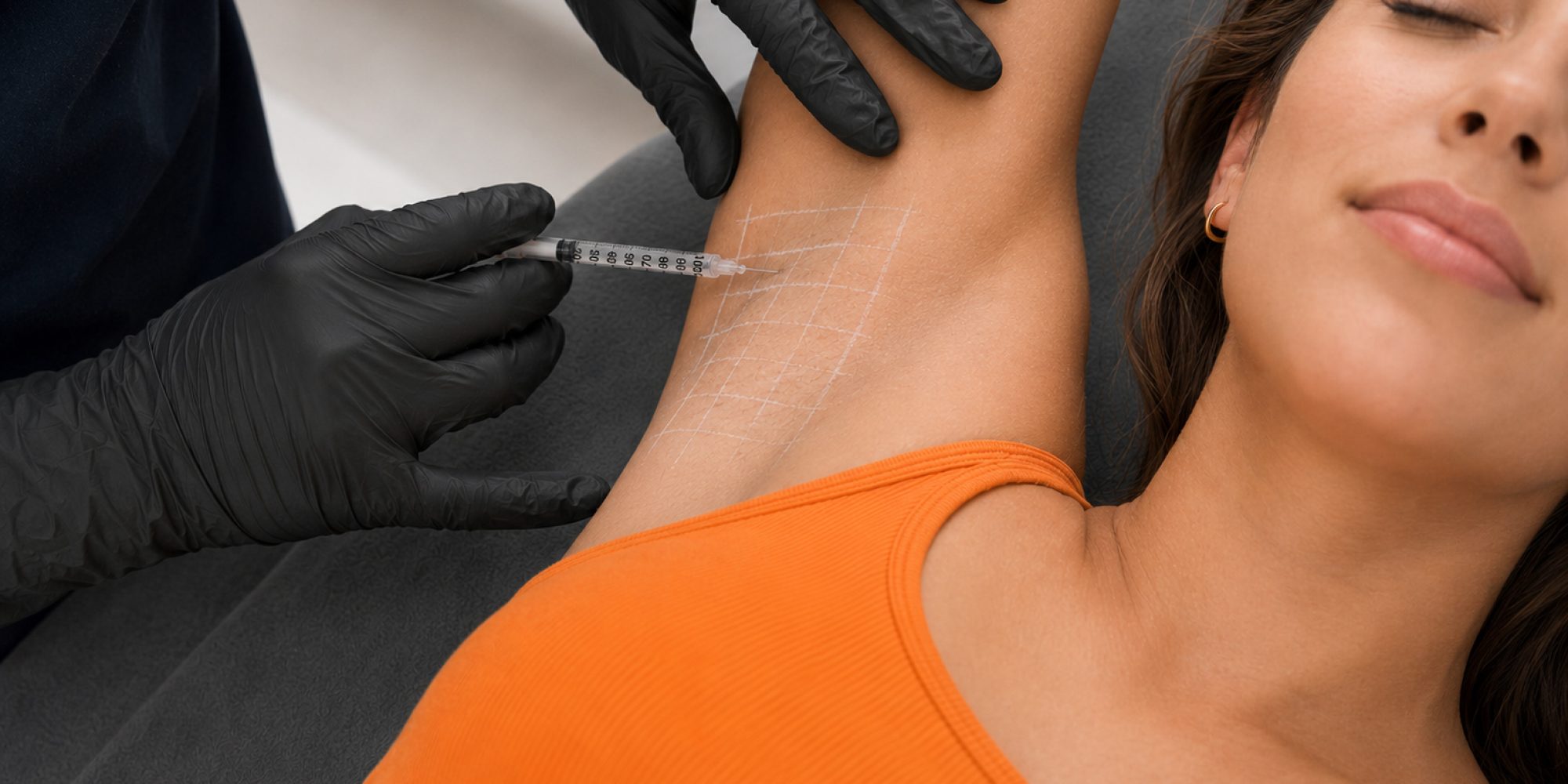 Hyperhidrosis Treatment