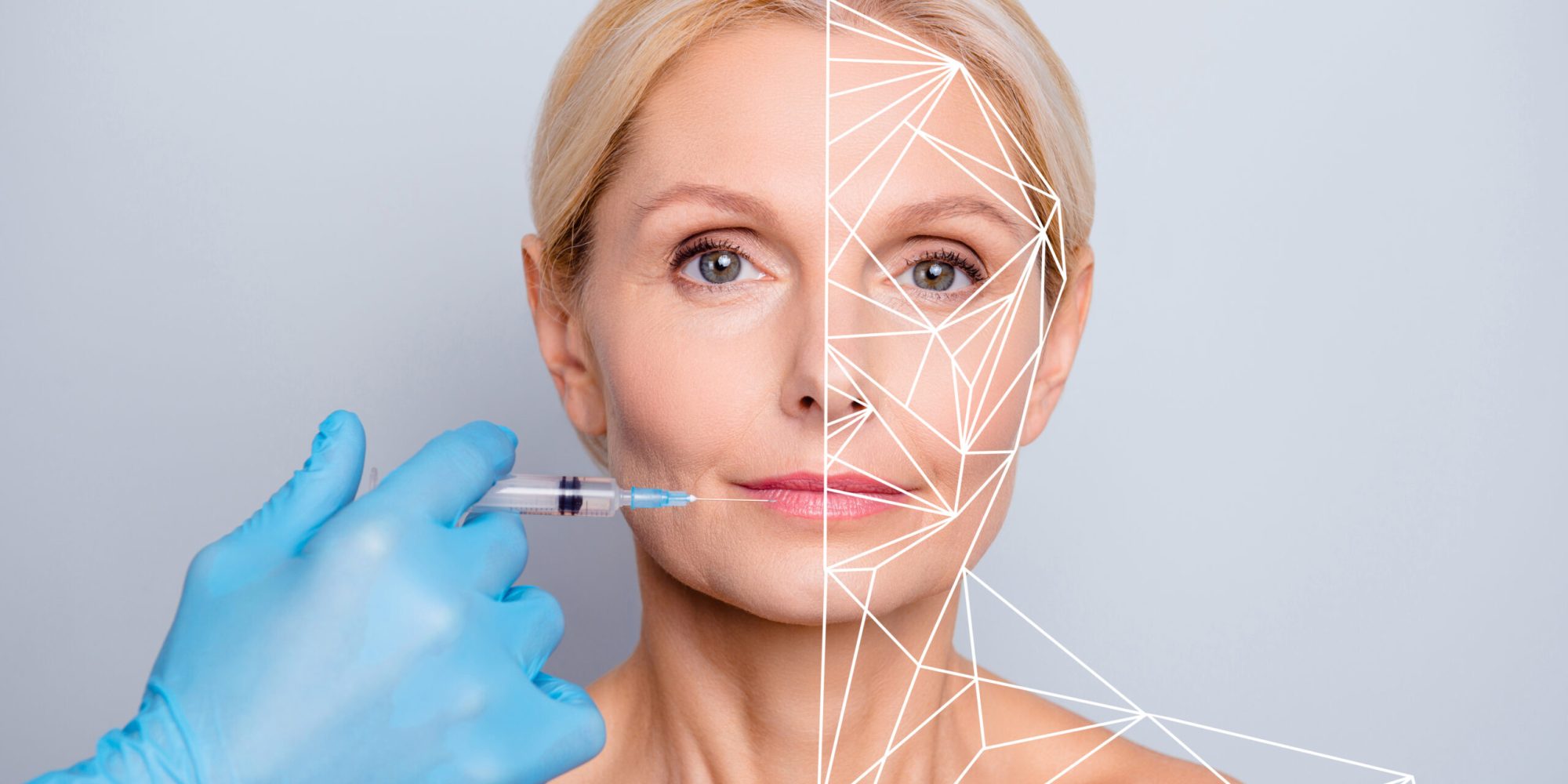 Sculptra Treatment Med Spa Washington DC
