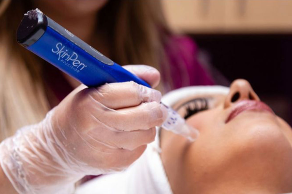 Skinpen Treatment