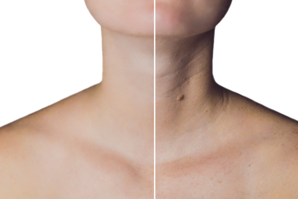 Tech Neck
