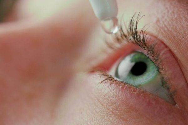 Upneeq Eyelid Lift Med Spa Washington DC